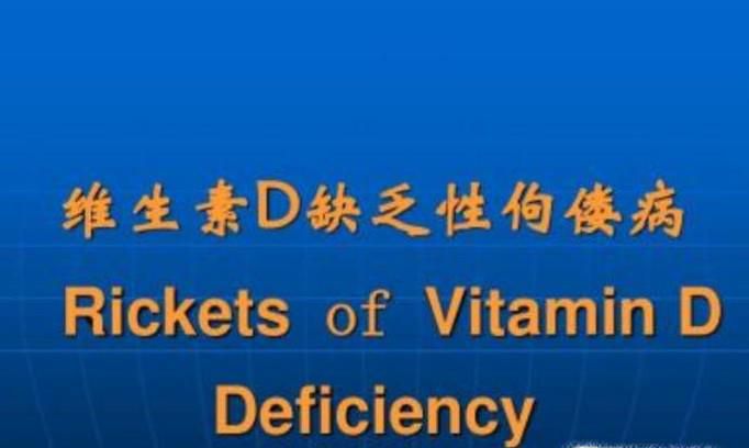 什么是维生素D缺乏性佝偻病