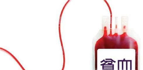 经常容易晕倒都有哪些原因？