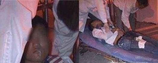 口吐白沫都有哪些原因？