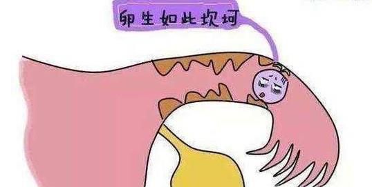 造成宫外孕的原因有哪些