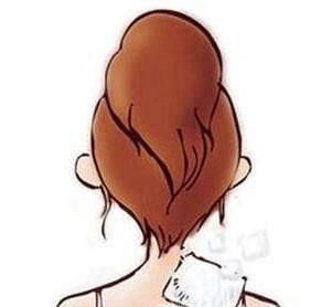 落枕了怎么快速好起来