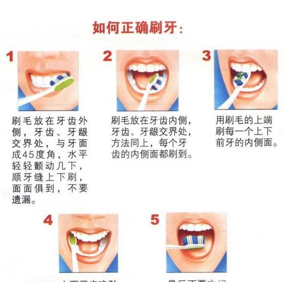 刷牙怎么做才是正确的
