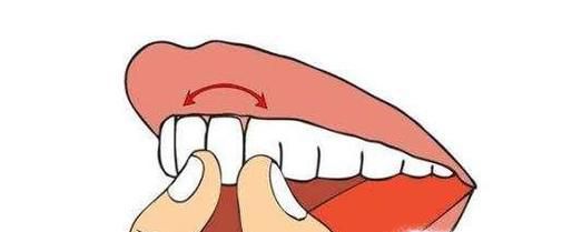 成人牙齿松动应该怎么办？