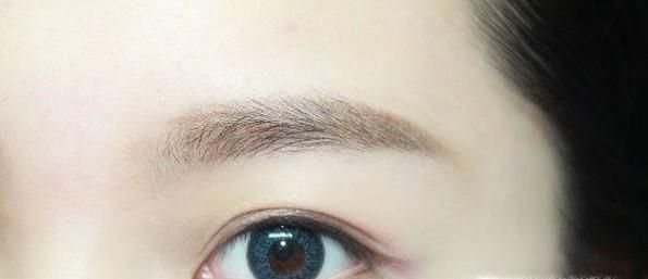 做开眼角时间是多久？