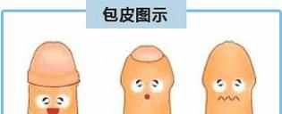做割包皮手术麻醉方式是什么？