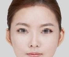 天津什么医院面部吸脂好？