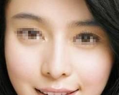 天津医院哪家做面部吸脂好？
