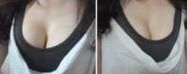 天津奥美定取出医院哪里比较好？