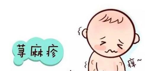 与荨麻疹一起生活 怎样治疗荨麻疹