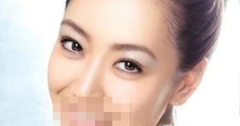 打瘦脸针后为什么会失败