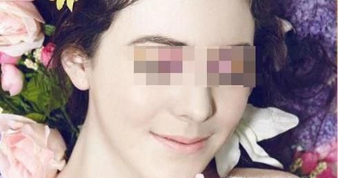 玻尿酸除皱的特点是什么呢