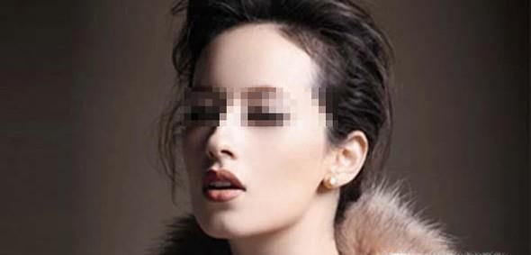 玻尿酸作为填充材料有怎样的优势?