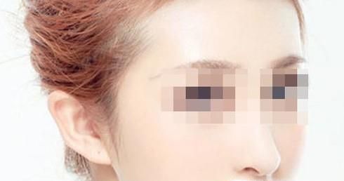 打瘦脸针会感到疼痛吗