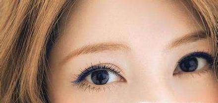 成都好的切开双眼皮整形医院在哪