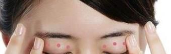 如何消除你的眼袋分享一个消除眼袋最有效的方法