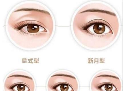做双眼皮埋线好还是全切好