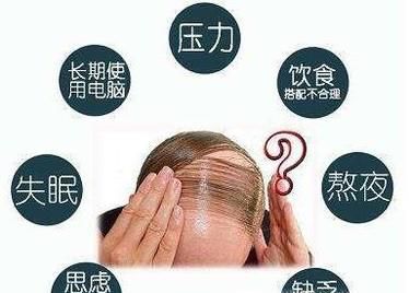重庆治疗脱发医院哪个最好
