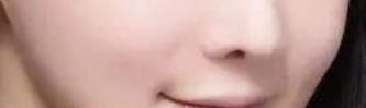 打玻尿酸的效果都有哪些