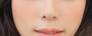 打美白针特点是什么