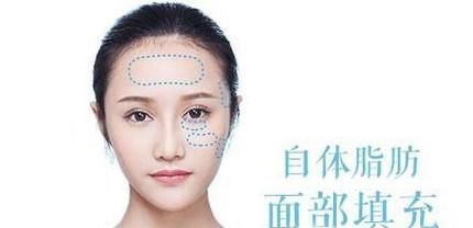 自体脂肪填充脸颊