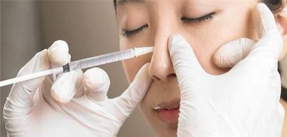 玻尿酸隆鼻效果看起来好不好