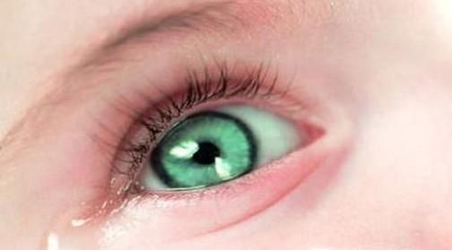 睡着了流眼泪是怎么回事？如何保护眼睛？