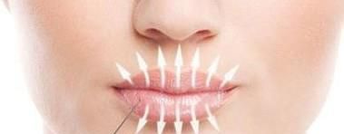 打玻尿酸的作用会有哪些呢