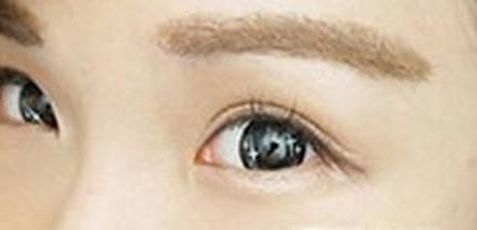 天津韩式双眼皮去哪家医院好