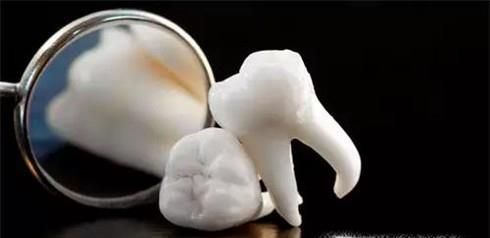 拔智齿的痛苦经历
