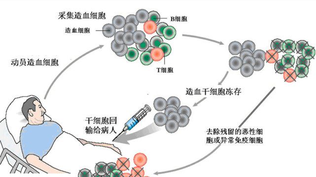 白血病可以预防吗？有哪些办法？