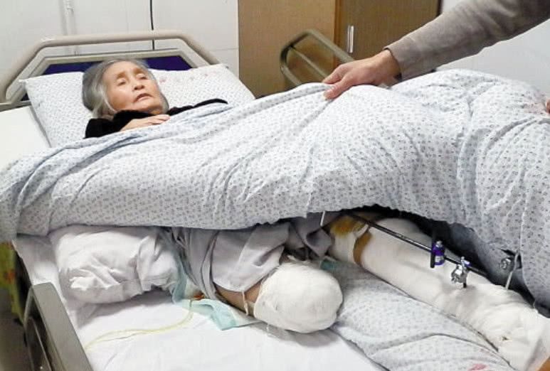 截肢后的肢体去哪里了,把断肢还给患者还是留在医院?