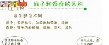 怎样鉴别痱子与湿疹