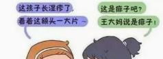 痱子和湿疹的区别