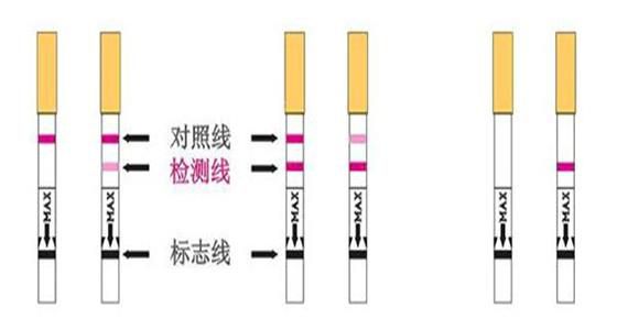 异位妊娠的检查