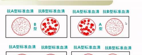 熊猫血的女性怀孕注意事项