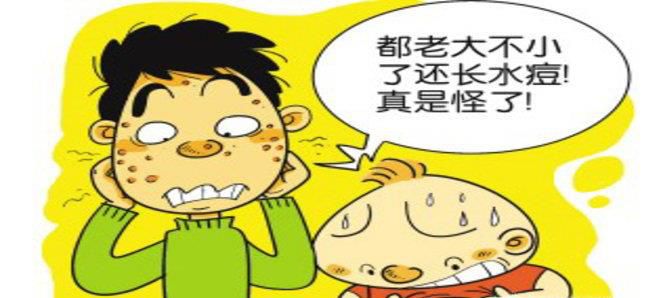 成人水痘不吃药可以自愈吗?