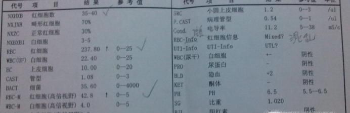 尿检报告单怎么看