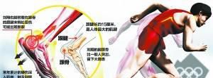 跟腱断裂的康复训练教程，手术后护理治疗方法