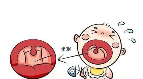 被鱼刺卡了怎么办