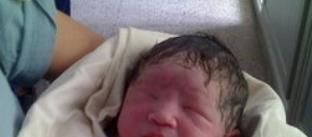 小孩黄疸怎么治疗 婴儿黄疸高怎么办
