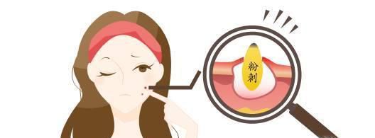 痘痘的种类有几种