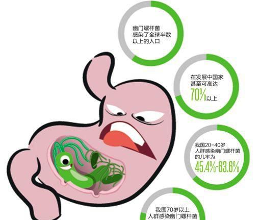 幽门螺旋杆菌最好的治疗方法是什么