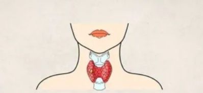 甲状腺结节怎么治疗最好的方法