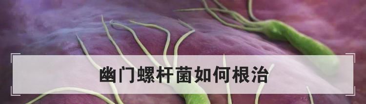 幽门螺杆菌如何根治
