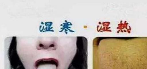如何区别寒湿与湿热这两种不同的体质