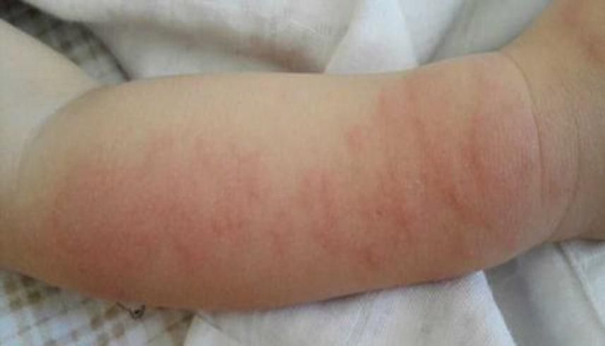 妈妈给宝宝换奶需注意事项