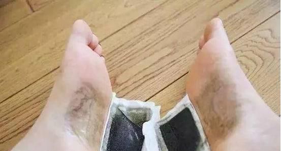 足贴变黑真的排毒吗为什么