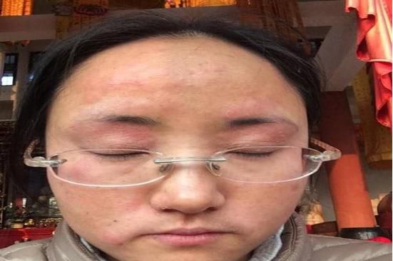 为啥会过敏不是反季节